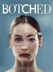 Botched Season 6 Episode 18