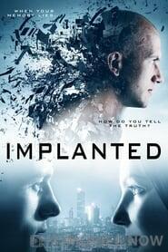 Implanted